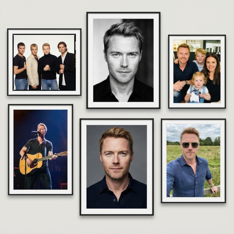 Ronan Keating Hair Transplant